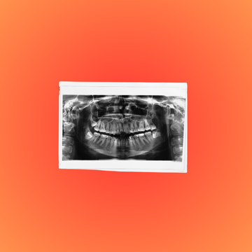 Dental Panoramic Films